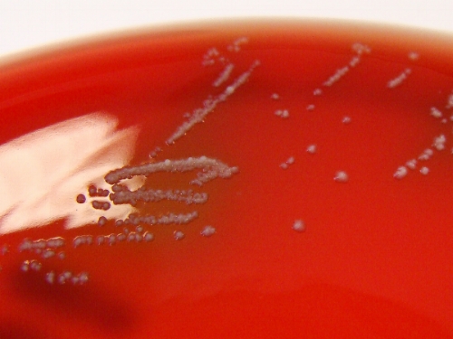 FIGURA 4. Colonias de Propionobacterium acnes, la bacteria responsable del acné.